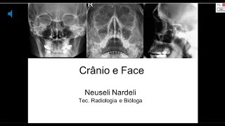 Aula 11  Tecnicas e Procedimentos II  Cranio e Face [upl. by Norval]