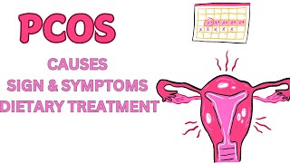 Polycystic Ovary Syndrome  PCOS  Causes  Sign  Symptoms amp Dietary Treatment [upl. by Eitsyrhc420]