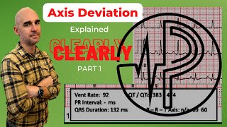 Do You Know Axis Determination You Need To and Its Easier Than You Think [upl. by Eeluj]