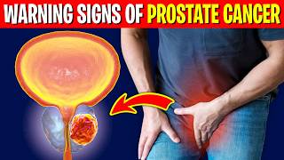 Warning Signs Of Prostate Cancer You Need To Know [upl. by Htnicayh]