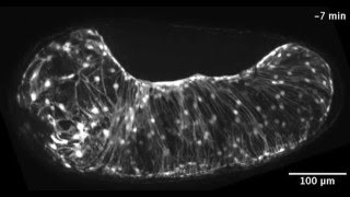 ZEISS ApoTome Tribolium extraembryonic tissue rupture and withdrawal [upl. by Bond155]