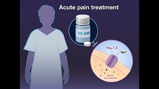 Selective Inhibition of NaV18 for Acute Pain  NEJM [upl. by Isaiah]