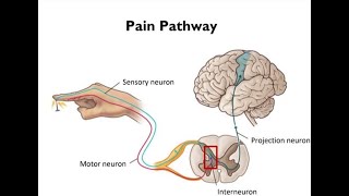 Electrotherapy Lecture 2 How do we perceive and treat pain  acute and chronic types [upl. by Eiliah]