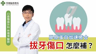 膠原蛋白對拔牙的好處！ [upl. by Heywood]