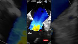 Infants in womb react to what their mothers eat  JustCare by American Garage Health [upl. by Henigman]