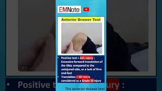 Anterior Drawer Test Knee ACL Injury doctor nursing [upl. by Shing]