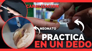 ¿Como CANALIZAR a un RECIEN NACIDO  VENOCLISIS  💉 Con DEMOSTRACION  ENFERMERIA [upl. by Kelli519]