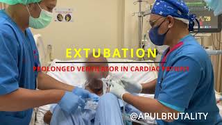 Extubation in prolonged mechanical ventilation in critical cardiac patient [upl. by Bolitho]