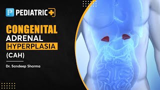 Congenital Adrenal Hyperplasia General Pediatrics  Dr Sandeep Sharma [upl. by Radnaxela]