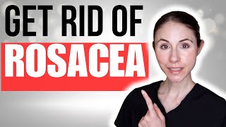 How To Get Rid Of Rosacea  Dermatologist Tips [upl. by Raual]