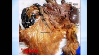 Surgical Anatomy of Cadaveric Abdominal Viscera  Dr Sanjoy Sanyal [upl. by Elokcin377]