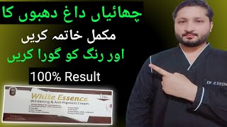 How to get rid of face melasma and dark spots  face whitening cream  Dr review white essence [upl. by Ayikat]