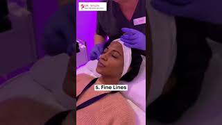 One solution to all your skin problems  Chemical Peel Treatment🌸 [upl. by Erik205]