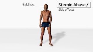 Side Effects of Steroids Abuse [upl. by Nnylireg]