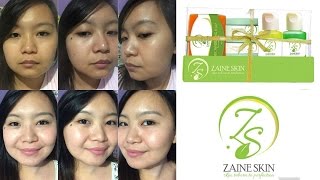 REVIEW  Zaine Skin Facial Set  CIAH MAE [upl. by Oicnanev]