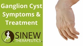 Ganglion Cyst Symptoms and Treatment [upl. by Columbus]