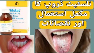 Nilstat Drops Uses  Nilstat Drops Side Effects  Mouth ulcer  Nystatin Uses in UrduHindi [upl. by Enna]