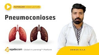 Pneumoconioses  Pathology Tutorials  Medical Education  VLearning  sqadiacom [upl. by Ayram]