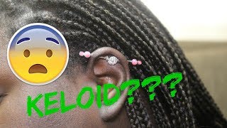 ONE MONTH INDUSTRIAL PIERCING UPDATE  KELOID amp PAIN [upl. by Ardnasak40]