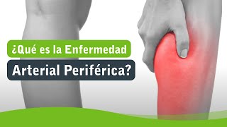 ¿Qué es la Enfermedad Arterial Periférica [upl. by Ylrahc188]