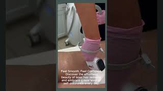 Laser Hair Removal MD Laser Clinic Burlingtonburlington laser hairremoval injectables [upl. by Calie]