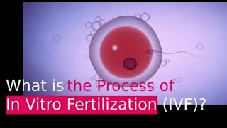 IVF PROCESS HELPFUL STEP BY STEP GUIDE In Vitro Fertilization [upl. by Vlada]