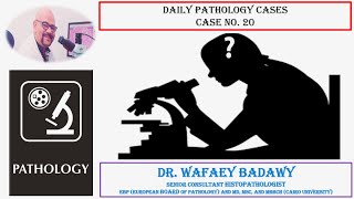 DAILY PATHOLOGY CASES CASE NO 20 BY DR WAFAEY BADAWY [upl. by Aivek925]