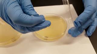 Oxidase Test [upl. by Muslim]