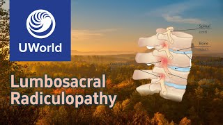 Lumbosacral Radiculopathy🍂neuroanatomy  UWorld Questions USMLE Step 1 Nervous System Neurology [upl. by Eibrab]