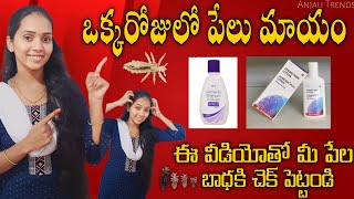 ఏ side effects లేకుండా low budget లో ఒక్క రోజులో పేలు మాయం Clear head lice amp Nits  Anjali Trends [upl. by Nadoj]