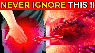 Early SIGNS of COLON CANCER you MUST NOT IGNORE [upl. by Balas]