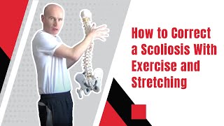 How to Correct a Scoliosis With Exercise and Stretching  Ed Paget [upl. by Ellertal233]