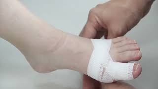 Toe Bandaging Principles and Tips [upl. by Giarla105]