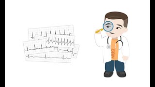 Making sense of common Holter ECG findings [upl. by Shirl]