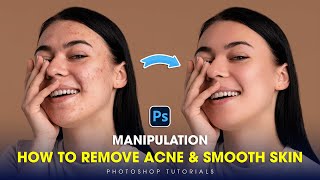 Adobe Photoshop 2025 Tricks Remove Acne Smooth Skin with Simple Steps in Minutes [upl. by Sanford915]