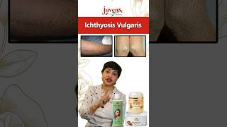 Ichthyosis Vulgaris skincare healthyskin selfcare ichthyosis skincaretips skin deadskincells [upl. by Banwell]