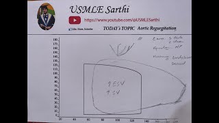 Aortic valve regurgitation  valvular heart disease USMLE step 1 [upl. by Ahsenahs370]