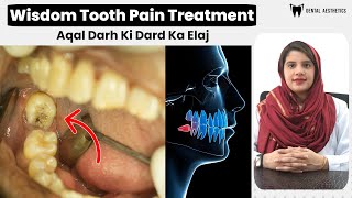 Wisdom Teeth Pain Treatments Aqal Darh Ki Dard Ka Ilaj  Why You Need Wisdom Tooth Extraction [upl. by Rubin]