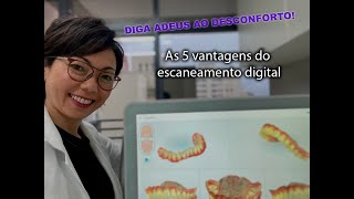 As 5 vantagens do escaneamento digital com Itero 5D [upl. by Jarid]