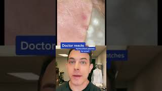 Do hydrocolloid patches work Dermatologist answers  208SkinDoc [upl. by Ahsiret]