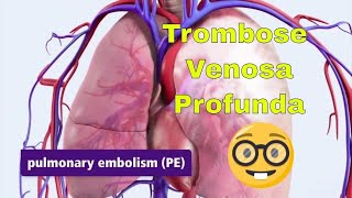 Trombose Venosa Profunda TVP e Embolia Pulmonar EP [upl. by Nicoline]