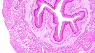 Histology of Esophagus mbbs histology [upl. by Neehar128]