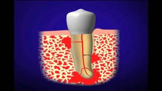 Dr Cliff Ruddle Introduction to Root Canal Treatment  Dentsply Sirona [upl. by Juditha]