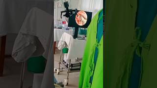 Tympanoplasty part2 educational  hospital jageshwarraj353 jageshwarraj353 [upl. by Radu979]