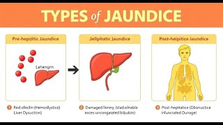 Jaundice  types causes symptoms newborn jaundice diet treatment [upl. by Ailuig]