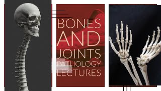 BONES AND JOINTS PATHOLOGY lecture 2 Congenital Disorders of bone made easy with important points [upl. by Hsirt]