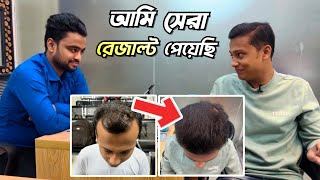 আমার রেজাল্ট এ সবাই অবাক  Best Hair Transplant Clinic In Bangladesh  Hair Transplant Result Dhaka [upl. by Atims642]