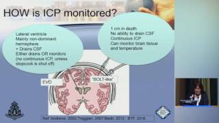 Mastering ICP Management [upl. by Ardnauq]