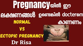 Ectopic Pregnancy Sign amp Symptoms Malayalam  Normal vs Ectopic Pregnancy Symptom  Tubal Pregnancy [upl. by Kile]