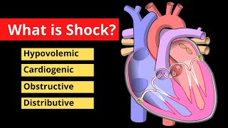 Shock Explained in 120 Seconds  Treatment Symptoms Causes  Video [upl. by Eiddet]